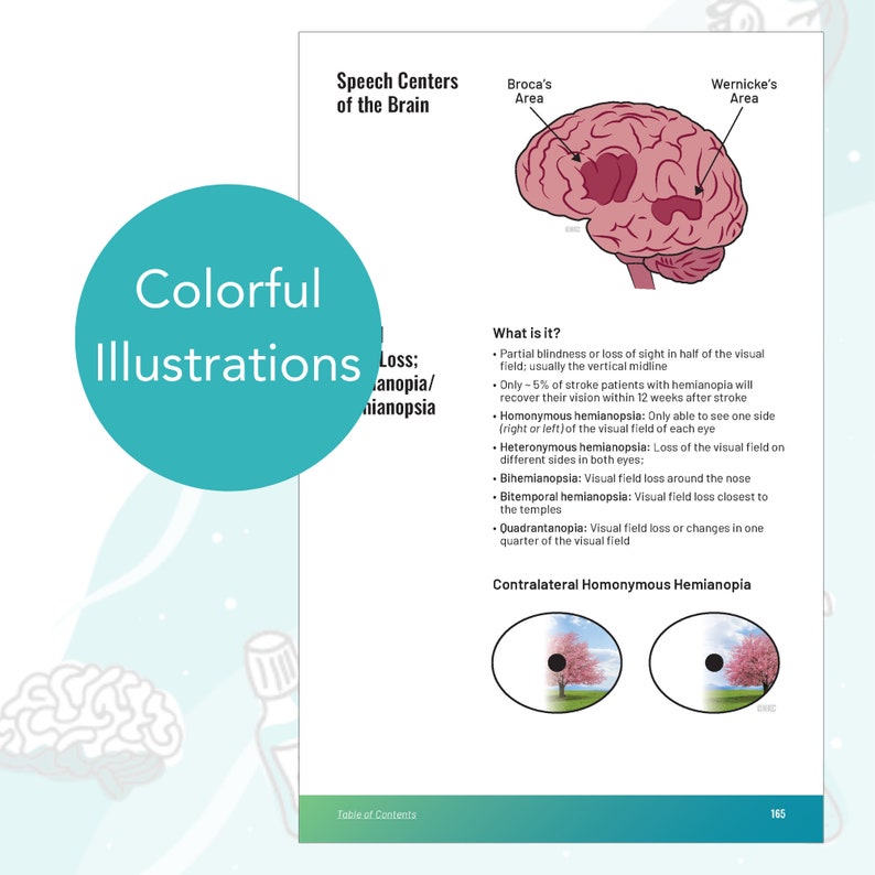 Brain speech centers diagram showing Broca's and Wernicke's areas — visual field loss hemianopsia reference chart for stroke assessment and neuro ICU nursing study.