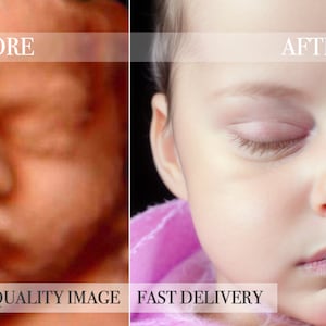 Photorealistic Baby Ultrasound | 8K Real View 3D/4D/5D/HD Imaging | Baby Shower Christmas Gift