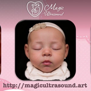 Animation of your unborn baby ultrasound face  | 8K Real View 3D/4D/5D/HD Imaging | Perfect Baby Shower Gift