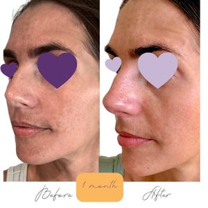 Brightening Skincare Set: Vegan Serum and Lotion | No Harsh Ingredients | Clean Skincare image 2