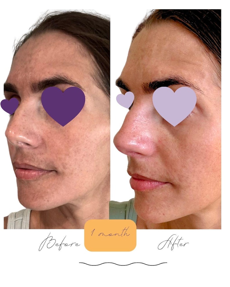 Brightening Skincare Set: Vegan Serum and Lotion | No Harsh Ingredients | Clean Skincare image 2