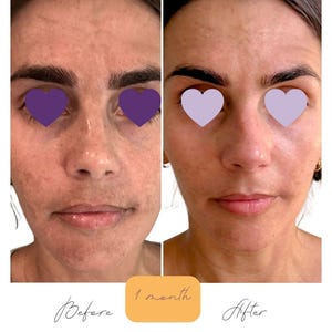 Brightening Skincare Set: Vegan Serum and Lotion | No Harsh Ingredients | Clean Skincare image 1