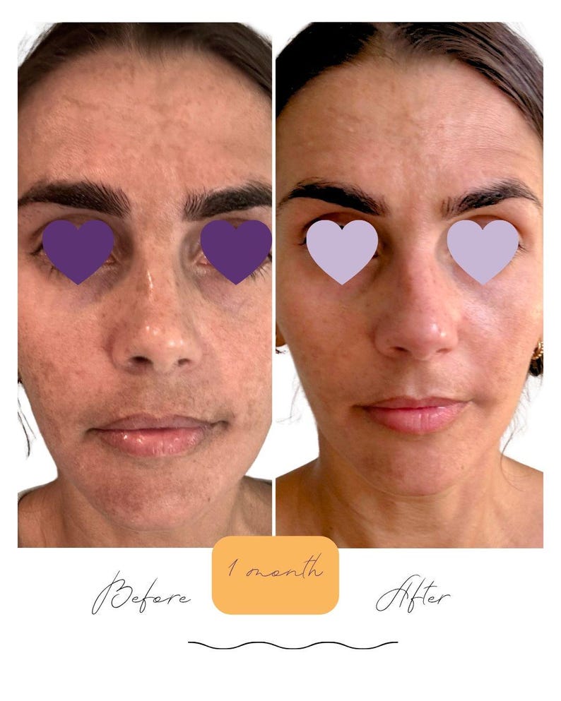Brightening Skincare Set: Vegan Serum and Lotion | No Harsh Ingredients | Clean Skincare image 1