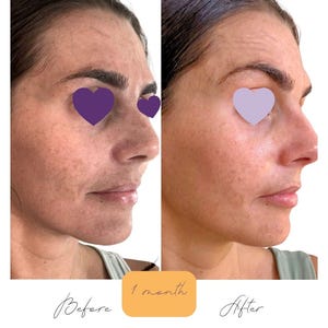 Brightening Skincare Set: Vegan Serum and Lotion | No Harsh Ingredients | Clean Skincare image 3