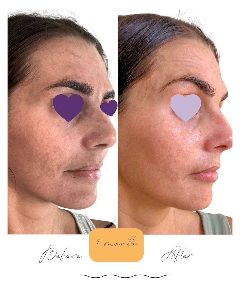 Brightening Skincare Set: Vegan Serum and Lotion | No Harsh Ingredients | Clean Skincare image 3