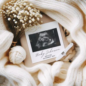 Ecografia per neonato, foto ecografica personalizzata, biglietto "Non vedo l'ora di incontrarti", regalo per papà, annuncio di gravidanza
