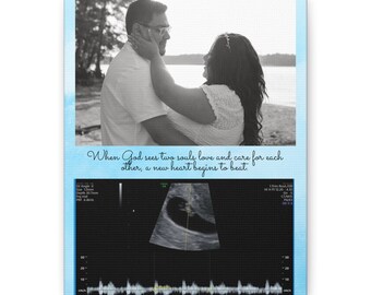 Envoltorios personalizados de galería de lienzos para baby shower