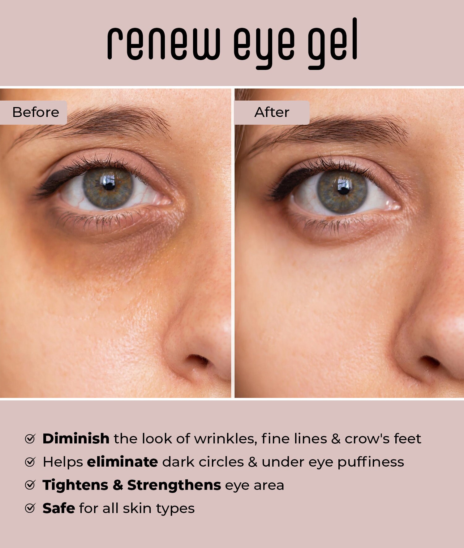 Under Eye Gel Serum for Bags & Puffy Eyes, Dark Circles, Wrinkles, Crow's Feet Treatment Etsy