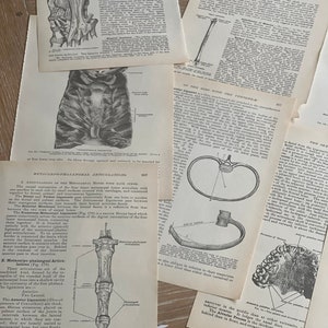 May include: A vintage anatomical illustration of the human foot, showing the bones and ligaments of the metatarsals and phalanges. The image is in black and white and features detailed labels for each bone and ligament.