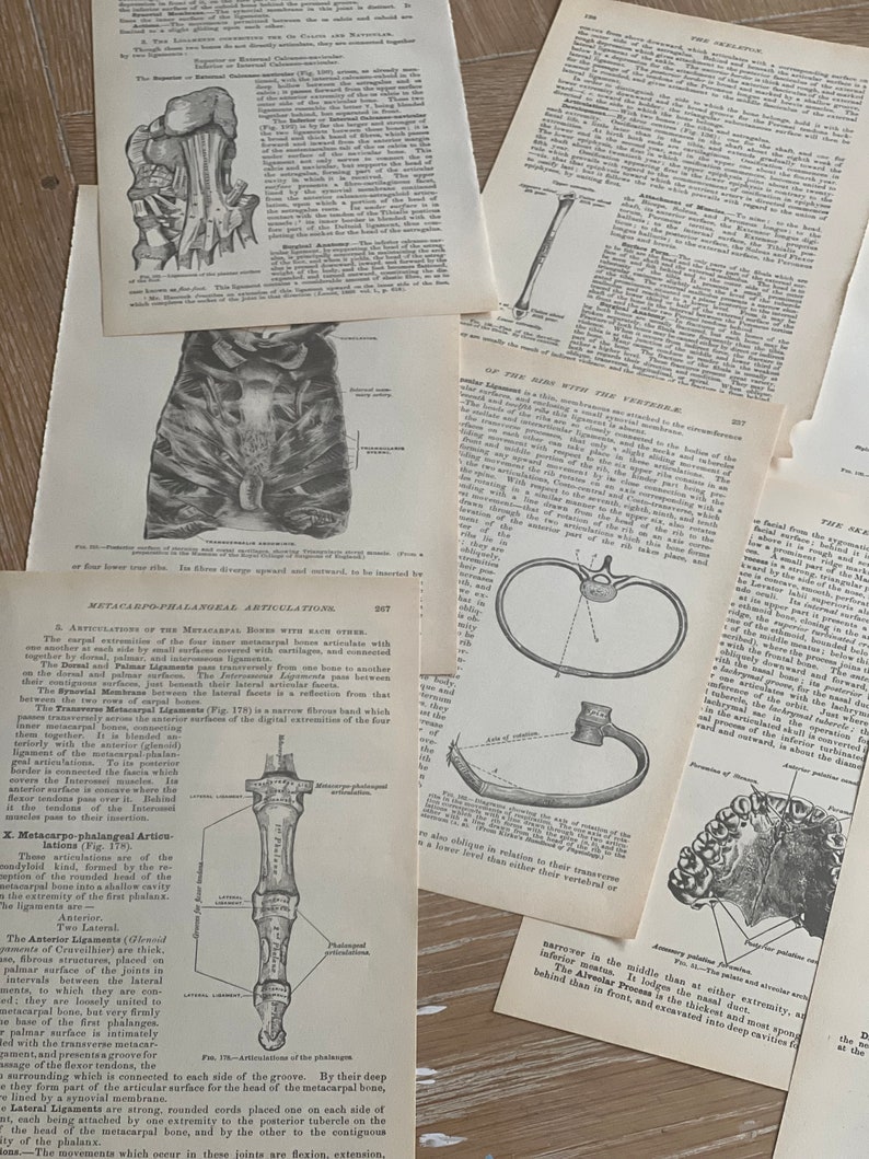 May include: A vintage anatomical illustration of the human foot, showing the bones and ligaments of the metatarsals and phalanges. The image is in black and white and features detailed labels for each bone and ligament.