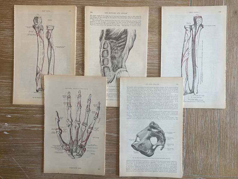 May include: Five vintage anatomical illustrations of the human body, including the forearm, hand, and pelvis. The illustrations are in black and white with red markings.