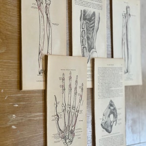 May include: Five vintage anatomical illustrations of the human hand and arm, printed on paper and mounted on a wood wall. The illustrations are in black and white and show the bones of the hand and arm.