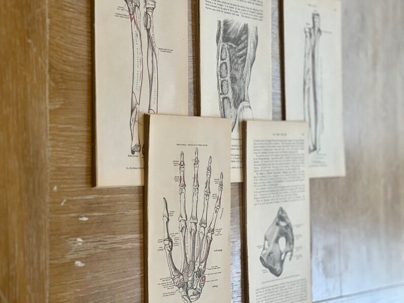 May include: Five vintage anatomical illustrations of the human hand and arm, printed on paper and mounted on a wood wall. The illustrations are in black and white and show the bones of the hand and arm.