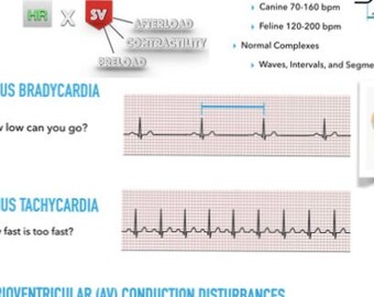 ECG Quick Reference Guide