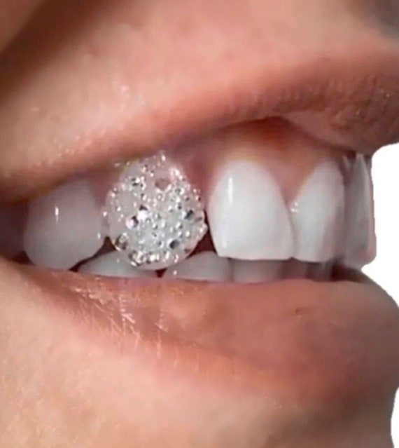 Kit 4 Coppie Cristalli Per Denti - Decorazioni Dentali Con Strass E Pietre Preziose - Foto 7