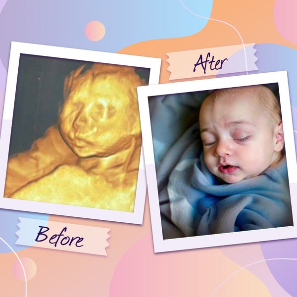 8K Verbesserter Baby-Ultraschall - Perfekte Babyparty-Überraschung und Ultraschall-Geschenk, Von Unebenheiten bis zu realistischen Gesichtern, Präzision 3D / 4D / 5D / HD-Bildgebung
