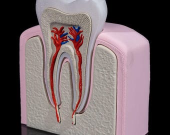 May include: An anatomical model of a human tooth cross-section featuring a white crown, beige dentin, and red and blue pulp canals. The tooth is embedded in a textured beige bone structure surrounded by a smooth, light pink gum tissue base.