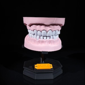 May include: A 3D printed dental model featuring white teeth set in pink gums, mounted on a black hexagonal stand. The base includes a small orange rectangular plaque with embossed text that reads 3D STAGE AREA, secured by two small silver-coloured screws.