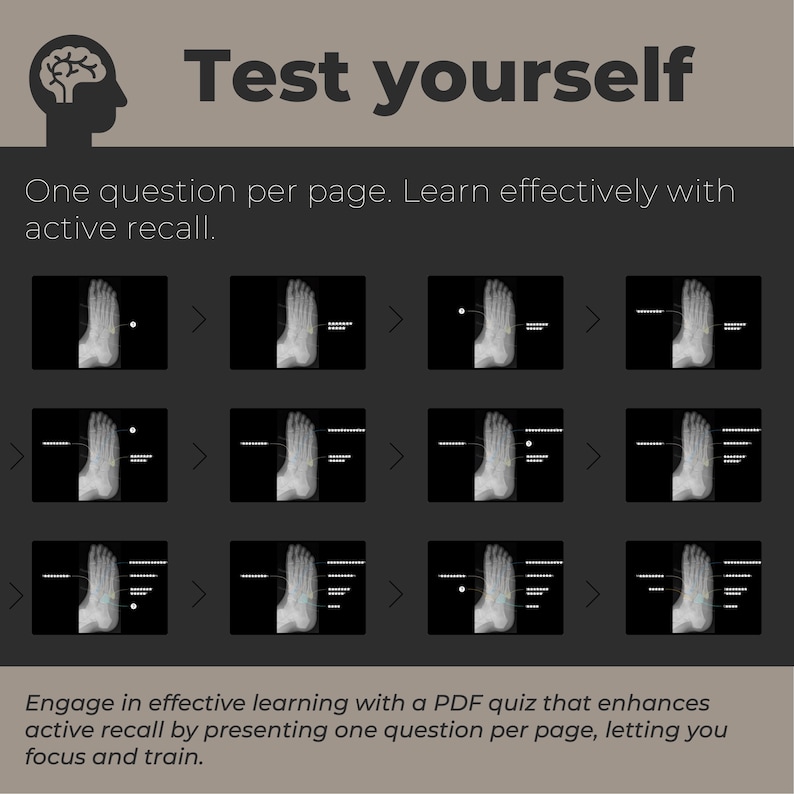 Foot Radiography Anatomy Radiology Study Aid for Beginner Annotated X