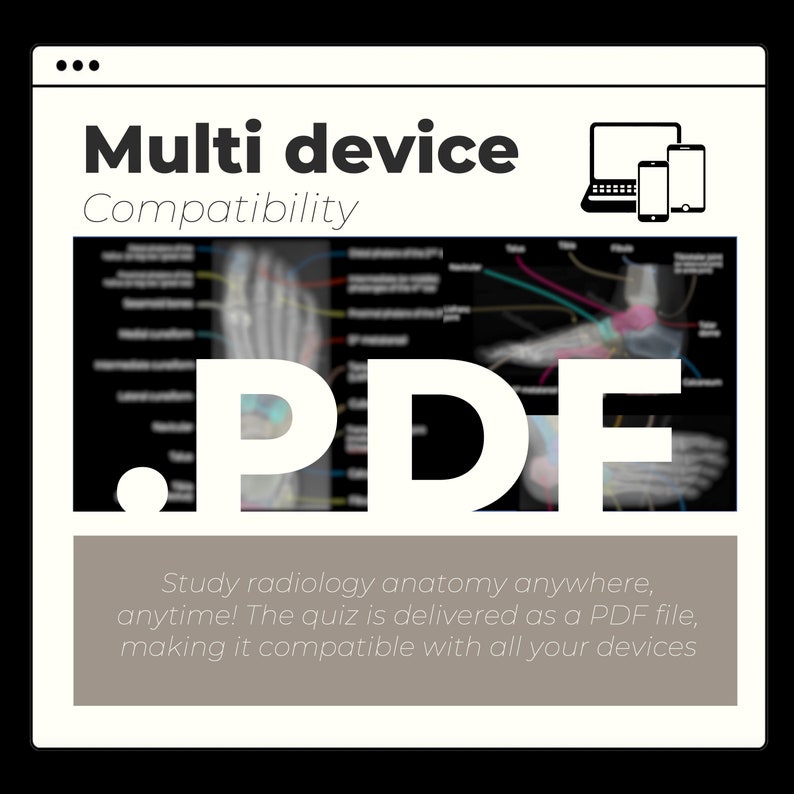 Foot Radiography Anatomy Radiology Study Aid for Beginner Annotated X