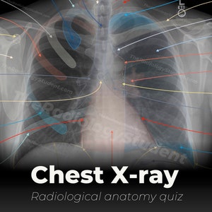 Puede incluir: Una imagen de rayos X de tórax en blanco y negro con estructuras anatómicas etiquetadas en diferentes colores. La imagen está etiquetada como "Radiografía de tórax" y "Quiz de anatomía radiológica".