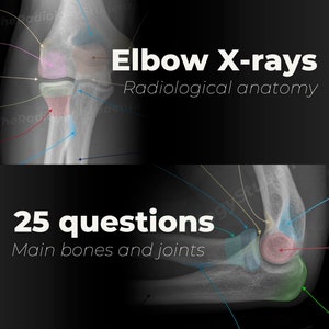 Elbow X-ray anatomy | Radiology study guide for rad tech