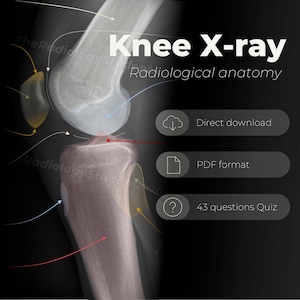 Könnte beinhalten: Ein schwarzweißes Röntgenbild eines menschlichen Knies. Das Bild ist mit "Knie-Röntgen" und "Radiologische Anatomie" beschriftet. Unter dem Bild befinden sich drei Schaltflächen: "Direkter Download", "PDF-Format" und "43 Fragen Quiz".