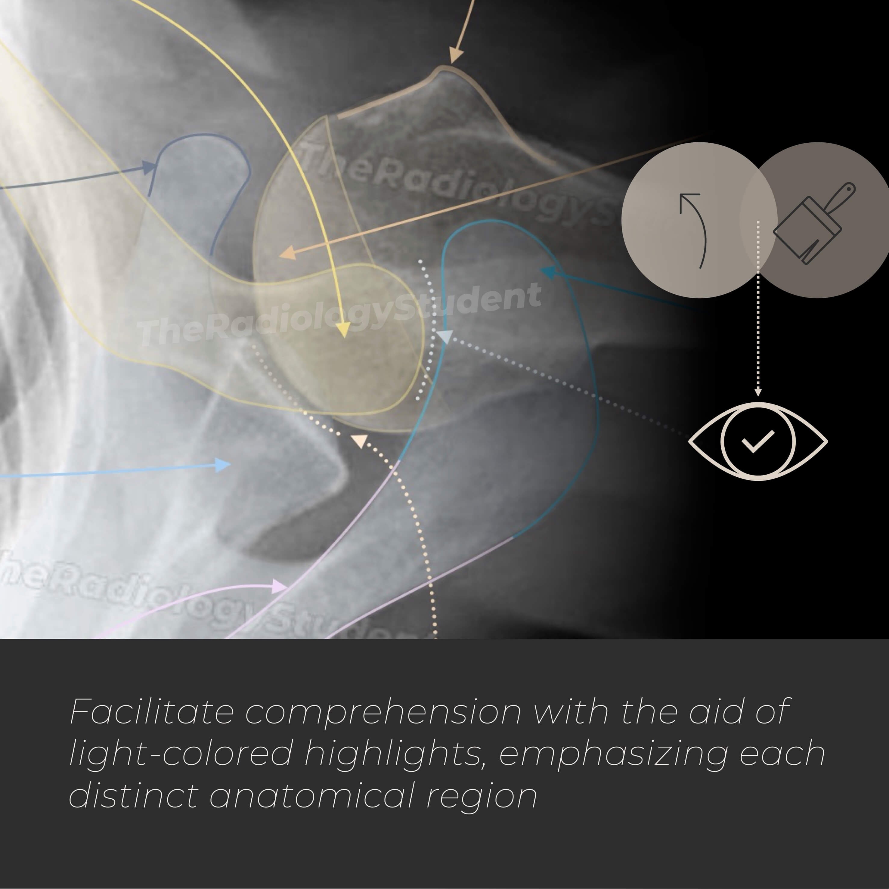 Shoulder Xrays Anatomy Quiz Study Guide for Radiology Student Etsy