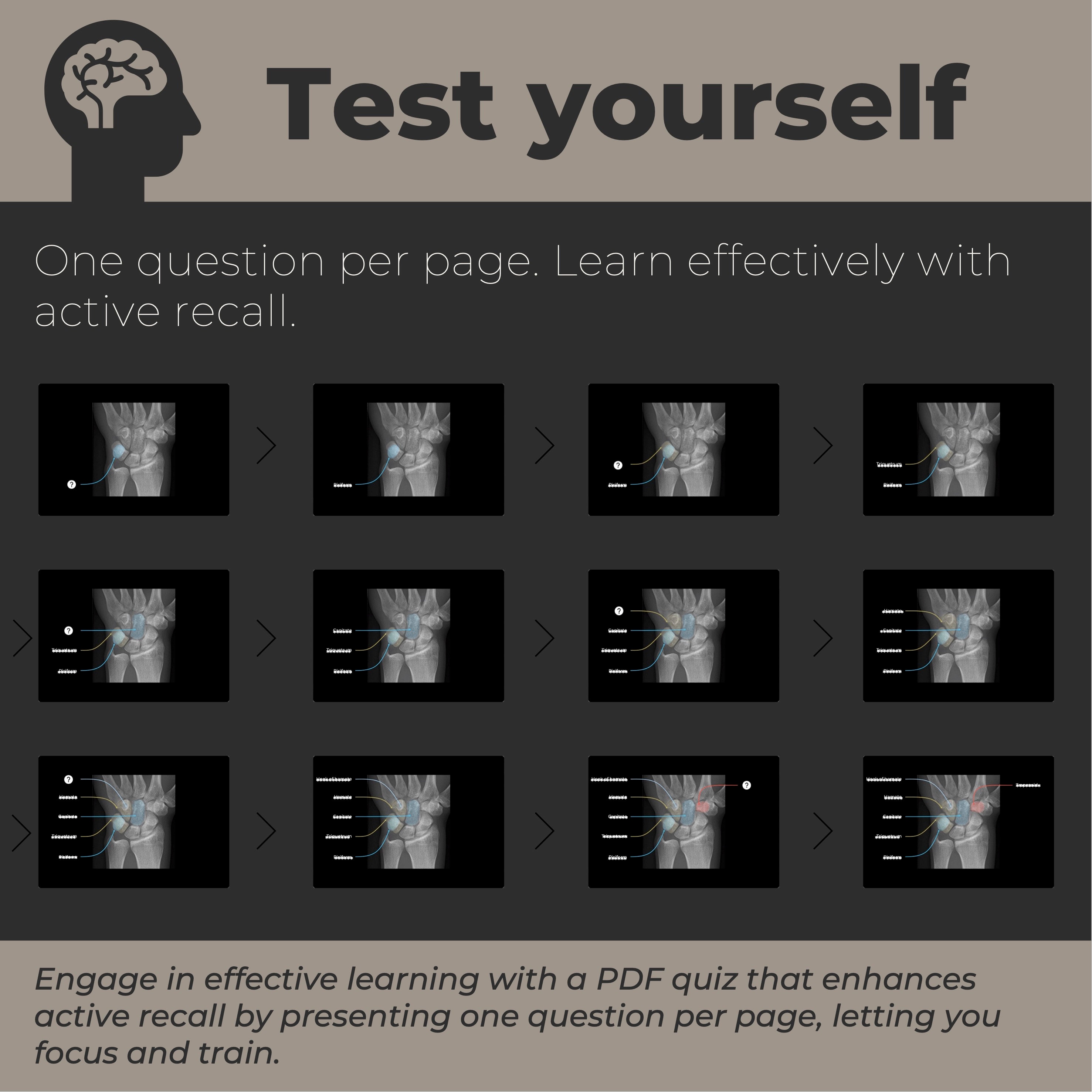 Hand and Wrist Xray Radiology Anatomy Quiz Study Materials for Medical