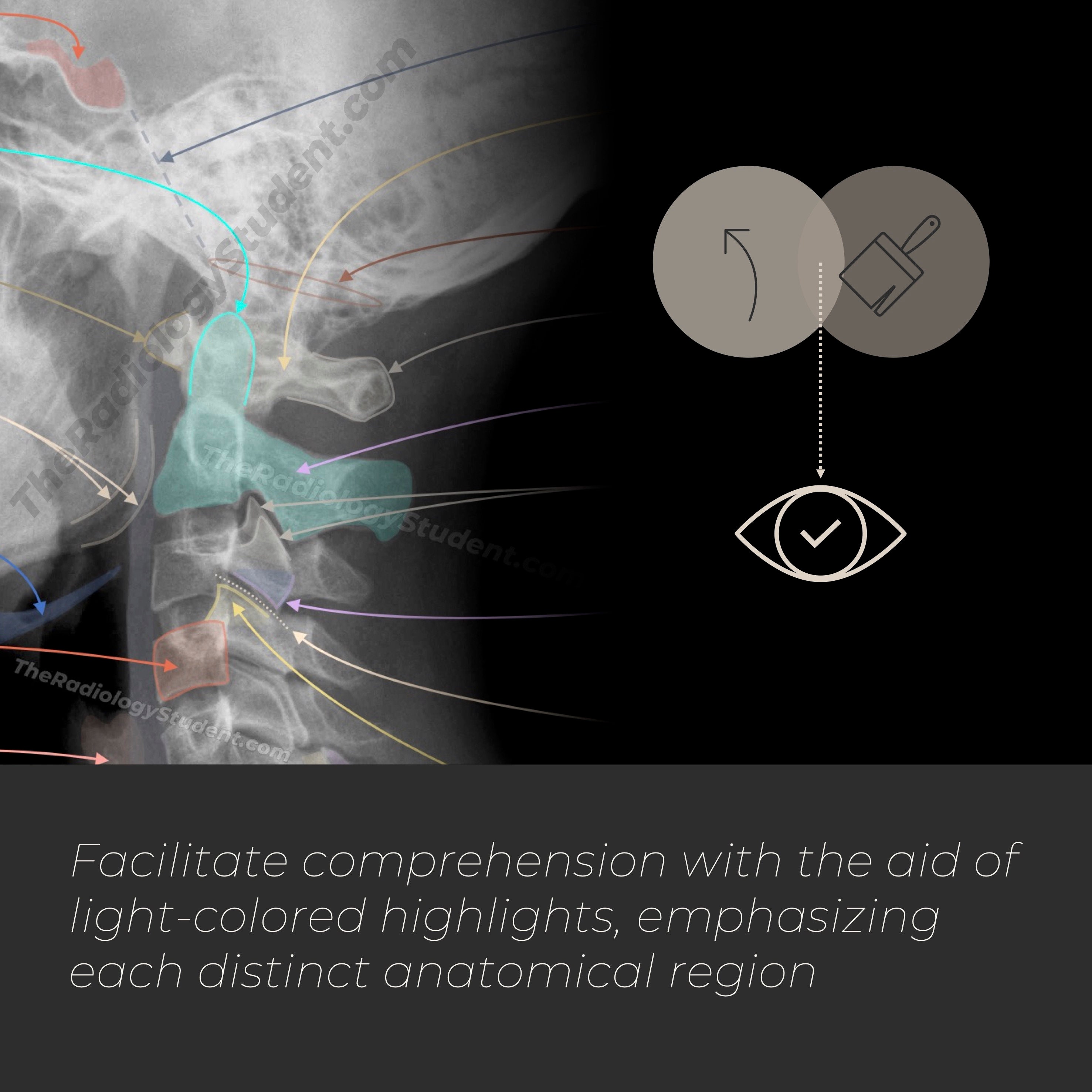 Cervical Spine Xray Anatomy Quiz Diagnostic Radiology Study Guide for