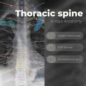 Thoracic spine xray anatomy | Neck bones and joint quiz | Radiology student study guide