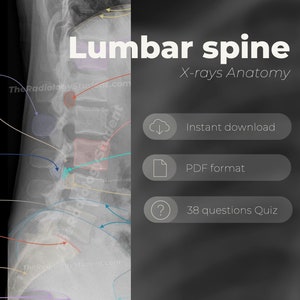 Lumbar spine radiology note | Annotated x-ray quiz to learn radiology