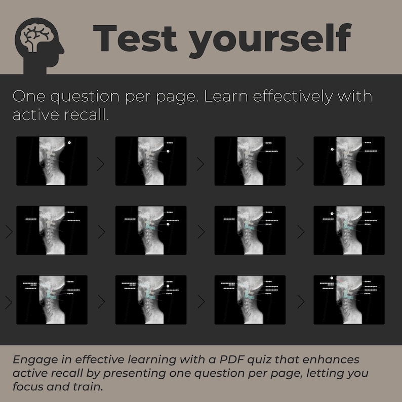 Cervical Spine Xray Anatomy Quiz Diagnostic Radiology Study Guide for