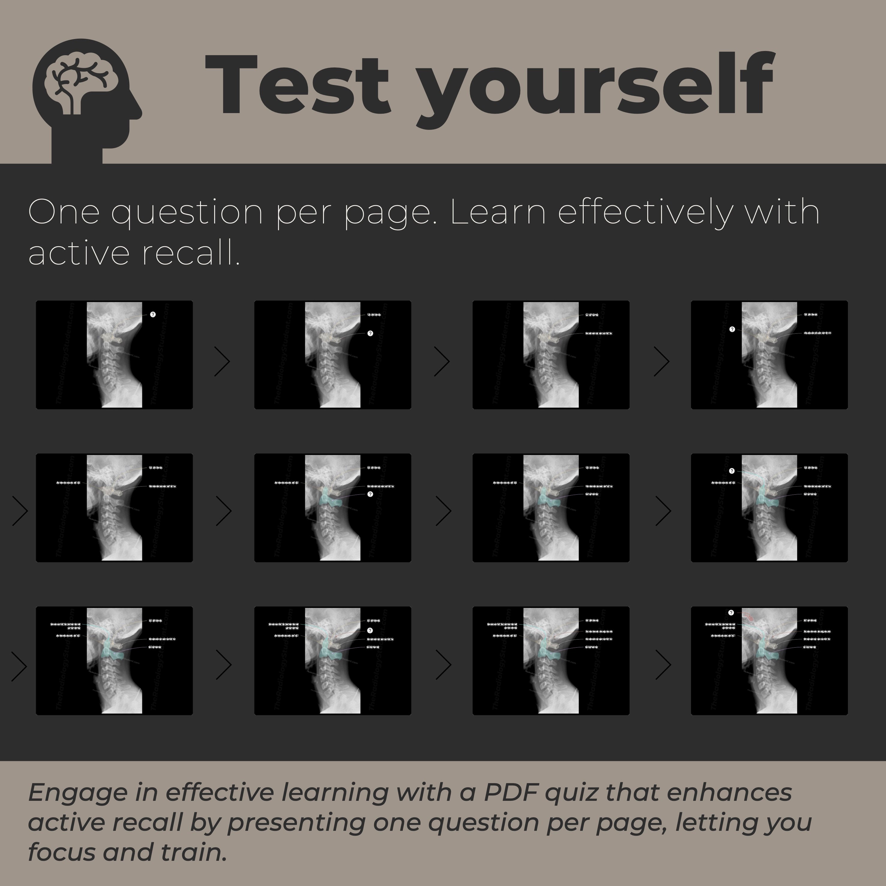Cervical Spine Xray Anatomy Quiz Diagnostic Radiology Study Guide for