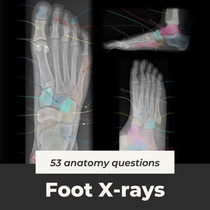 May include: Three black and white X-ray images of a human foot, with labels and lines pointing to different bones. The text "53 anatomy questions" and "Foot X-rays" are at the bottom of the image.