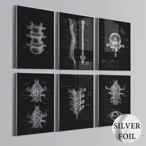 Könnte beinhalten: Ein Set aus sechs gerahmten Wandbildern mit weißen anatomischen Illustrationen der menschlichen Wirbelsäule und Wirbel auf schwarzem Hintergrund. Jeder Druck enthält detaillierte medizinische Beschriftungen. Ein silberner Aufkleber ist zu sehen.