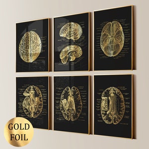 May include: A set of six framed wall art prints featuring gold foil anatomical brain illustrations on black backgrounds. Each print displays detailed cross-sections and views of the human brain with scientific labels in Latin text.