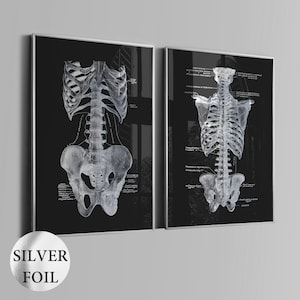2 skelet anatomie posters medische kunst orthopedische cadeau menselijk skelet diagram kliniek decor orthopedisch chirurg cadeau zilverfolie print
