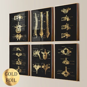 6 Wirbelsäule Wirbelsäule Anatomie Art Wirbel Poster Spinal Diagram Medizinische Kunst Orthopädie Geschenk Chiropraktik Klinik Dekor Goldfolie Druck