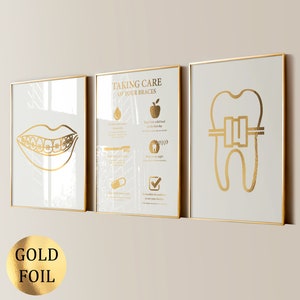 Set di 3 poster di apparecchi ortodontici in oro, poster di attacchi per denti, poster di stomatologia, ortodonzia, clinica dentistica, decorazione da parete, regalo dentista, lamina d'oro