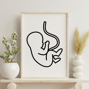 Newborn Baby Fetus Sketch, Newborn Print, Baby Birth Wall Art, Baby Wall art Print, Nursery baby room Decor, One Line art ,Digital Download