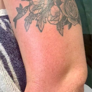 May include: Close-up of a person's arm with a black and grey tattoo of a Native American wearing a headdress and a rose. The tattoo is on the upper arm and the skin is red and irritated.