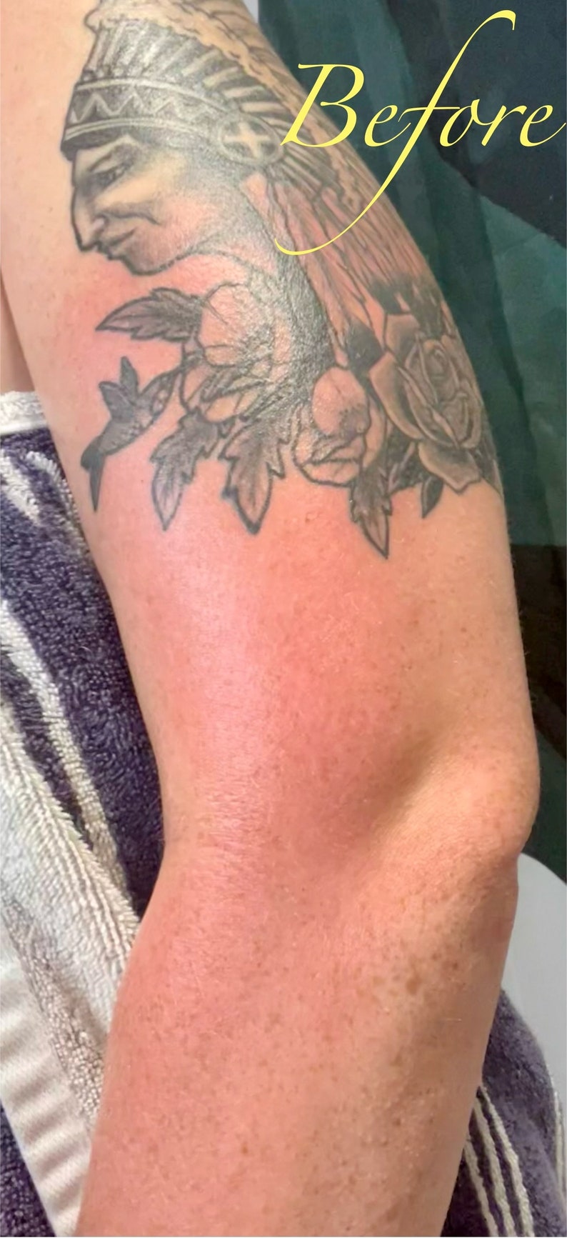 May include: Close-up of a person's arm with a black and grey tattoo of a Native American wearing a headdress and a rose. The tattoo is on the upper arm and the skin is red and irritated.