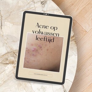 Op de afbeelding: Een digitale tablet toont de tekst "Acne op volwassen leeftijd" boven een afbeelding van huid met acne. De tablet heeft een zwarte rand en staat op een marmeren tafel. Het websiteadres www.bellezzaavanti.nl staat onderaan.