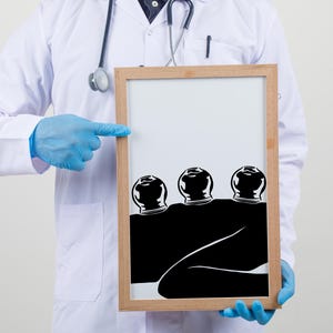 Konsttryck med koppningsterapi, akupunkturposter (digital nedladdning) bild 18