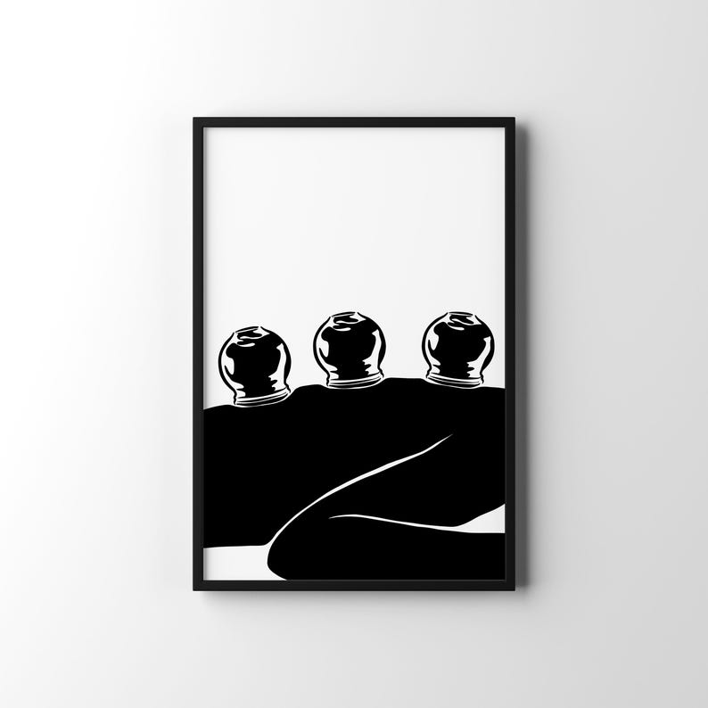 Konsttryck med koppningsterapi, akupunkturposter (digital nedladdning) bild 16