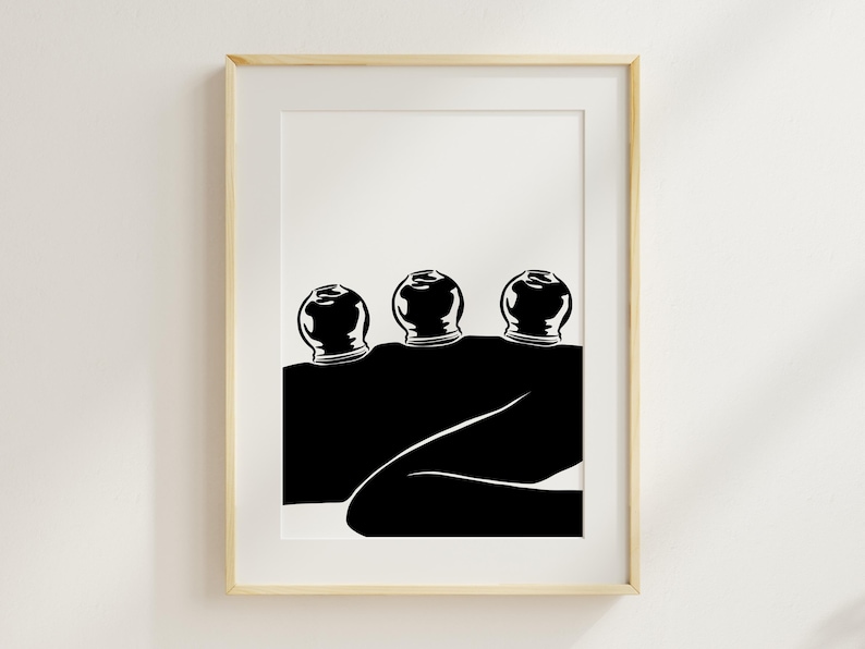Konsttryck med koppningsterapi, akupunkturposter (digital nedladdning) bild 15