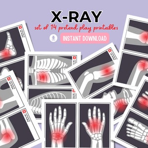 May include: A set of 14 printable X-ray images for pretend play. The images show different bones in the body, with red highlights indicating areas of pain or injury.  The text "X-RAY set of 14 pretend play printables INSTANT DOWNLOAD" is at the top of the image.