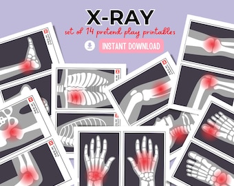 May include: A set of 14 printable X-ray images for pretend play. The images show different bones in the body, with red highlights indicating areas of pain or injury.  The text "X-RAY set of 14 pretend play printables INSTANT DOWNLOAD" is at the top of the image.