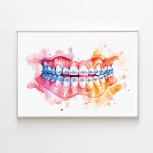 May include: Watercolor painting of a set of teeth with blue braces. The gums are painted in shades of pink and red, with a watercolor effect. The background is white.